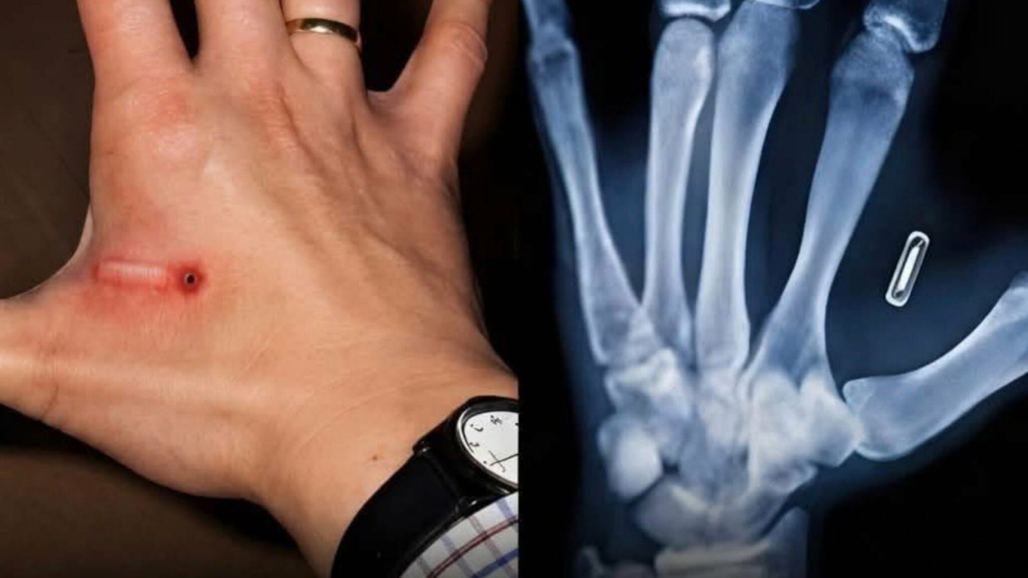Sweden implants microchips in citizens to replace IDs and credit cards